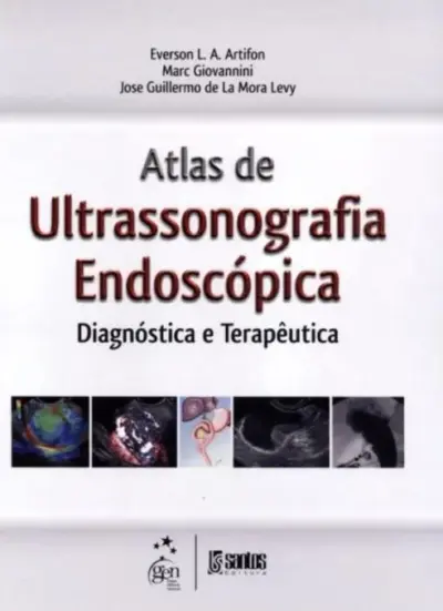 Atlas de ultrassonografia endoscópica