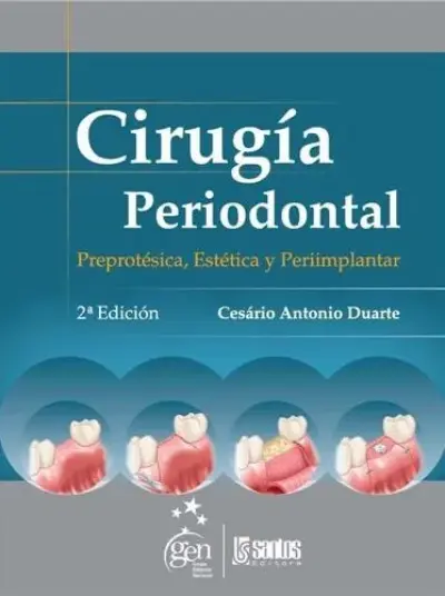 Cirugía periodontal