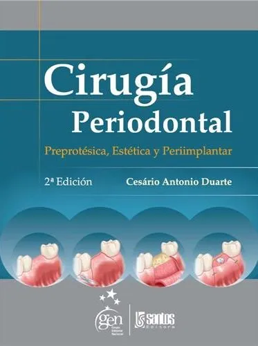 Cirugía periodontal: preprotésica, estética y periimplantar Cirugía periodontal: preprotésica, estética y periimplantar