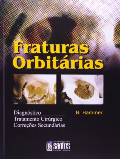 Fraturas orbitárias