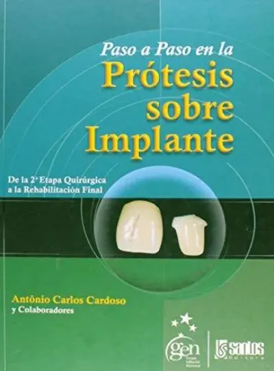 Paso a paso en la protesis sobre implante