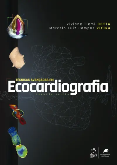 Técnicas avançadas em ecocardiografia