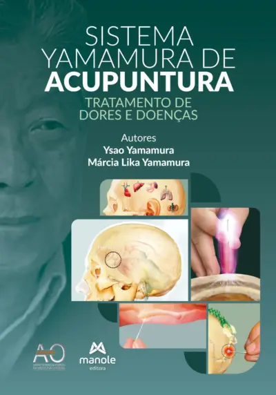 Sistema Yamamura de acupuntura
