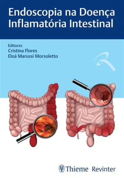 Endoscopia na Doença Inflamatória Intestinal