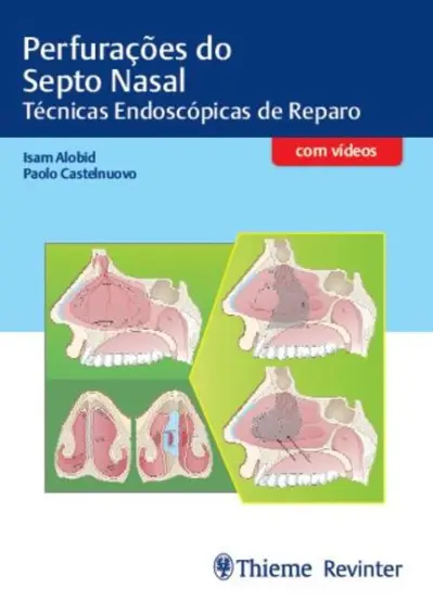 Perfurações do Septo Nasal