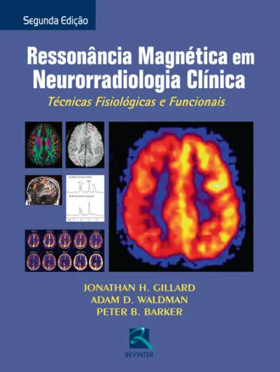 Ressonância Magnética em Neurorradiológica Clínica