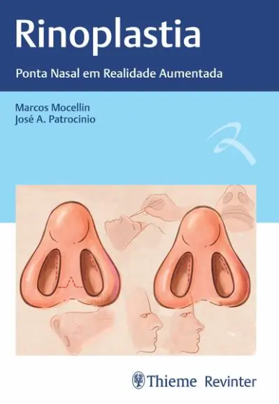 Rinoplastia