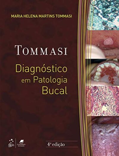 Diagnóstico em Patologia Bucal